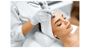 microdermabrasion chicago